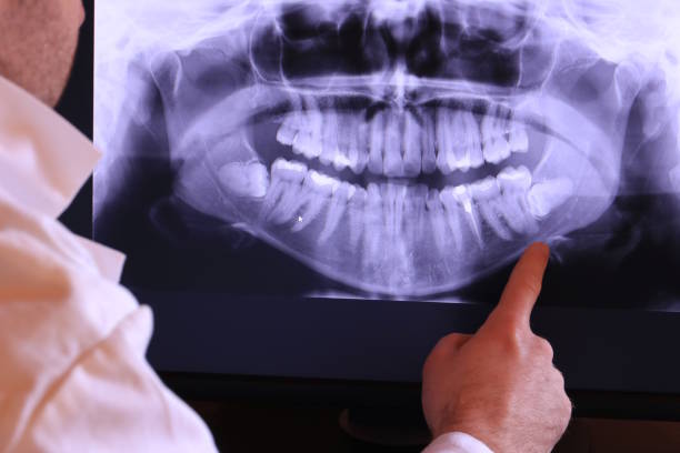 Best Tooth Infection Emergency Dentist  in Casselton, ND