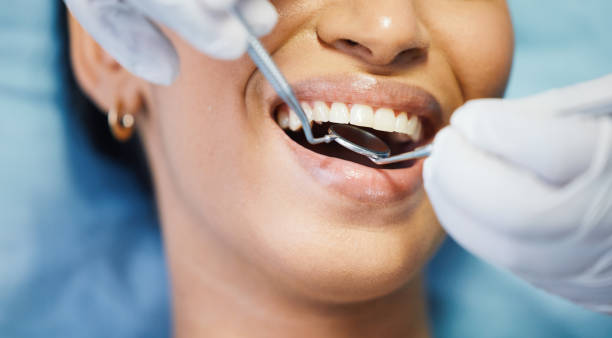 Best Emergency Tooth Extraction  in Casselton, ND